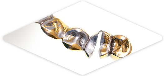 金銀パラジウム 金合金 歯科 金属