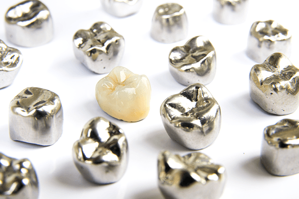 歯科　金属　金パラ　銀歯